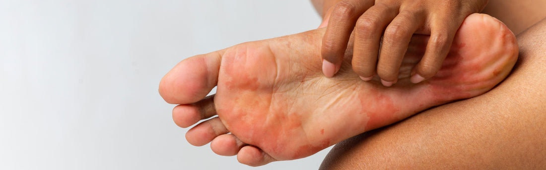 Can Diabetes Cause Foot Pain?