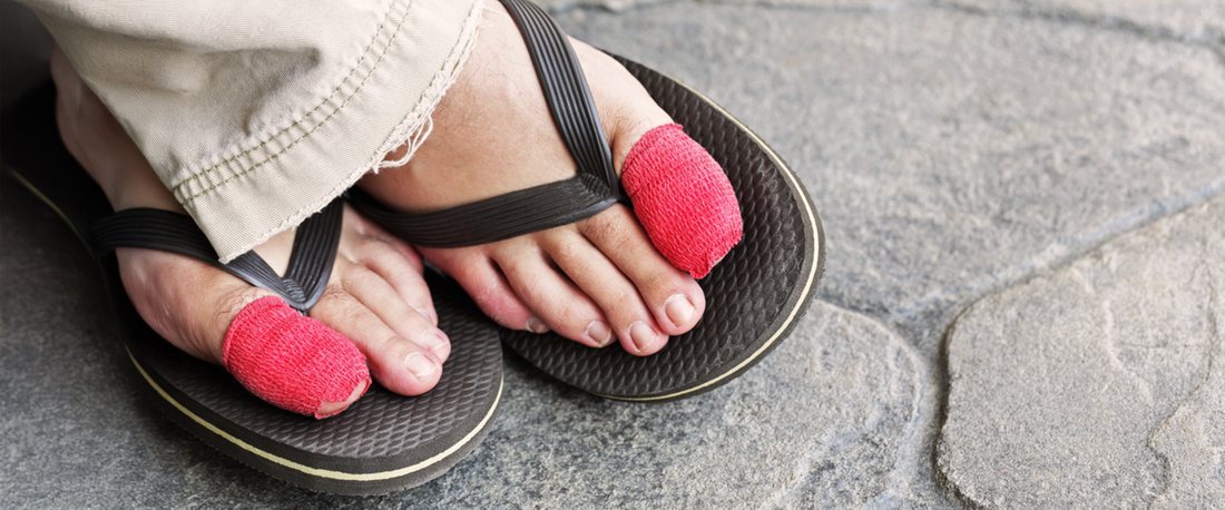 Ingrown Toenails: Causes, Prevention, and How g-defy Can Help